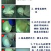 嚴重壁癌專用超值組:圖片 4